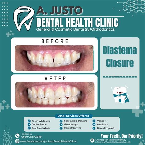 justo dental clinic|Alfred Justo Dental Health Clinic .